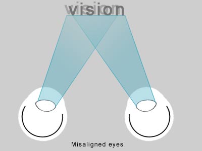 ראייה באצעות שתי עיניים מאפשרת ראיית עומק